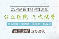 欧米茄超霸系列3578.51.00腕表 价格
